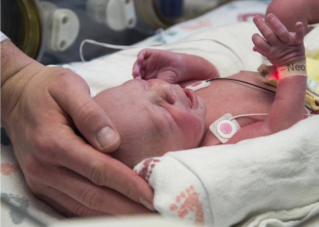 Rođena je prva beba u SAD nakon transplantacije materice